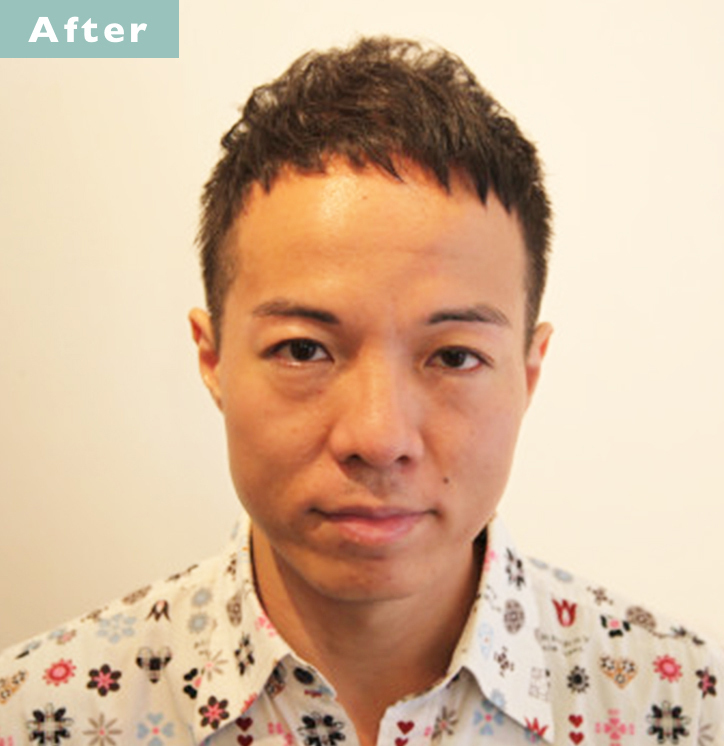 【プロが監修】薄毛をカバーできる髪型に変身!ハゲのタイプ別ヘアカタログ「広くなったおでこ」 3番目の画像
