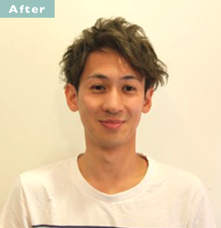 【プロが監修】薄毛をカバーできる髪型に変身!ハゲのタイプ別ヘアカタログ「広いおでこ」 3番目の画像