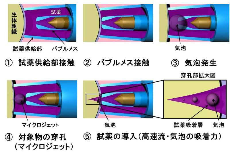 全く痛くない「針なし注射」を日本の大学が開発！　これで注射の恐怖から開放される 3番目の画像