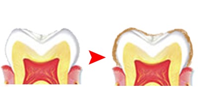 なぜ仕事ができる人は「歯が白い」のか？　歯を白くする4つの基本と意外な食べ物 4番目の画像