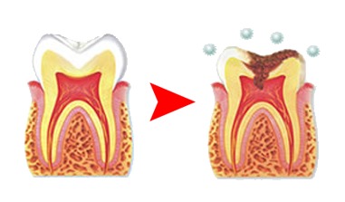 なぜ仕事ができる人は「歯が白い」のか？　歯を白くする4つの基本と意外な食べ物 5番目の画像